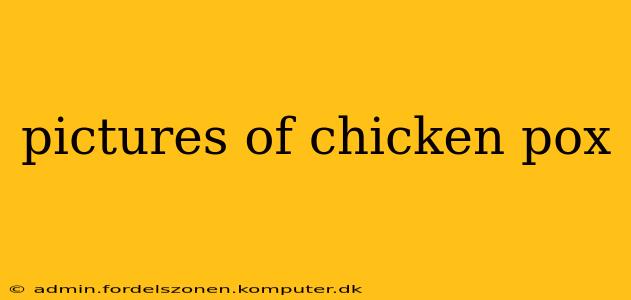 pictures of chicken pox